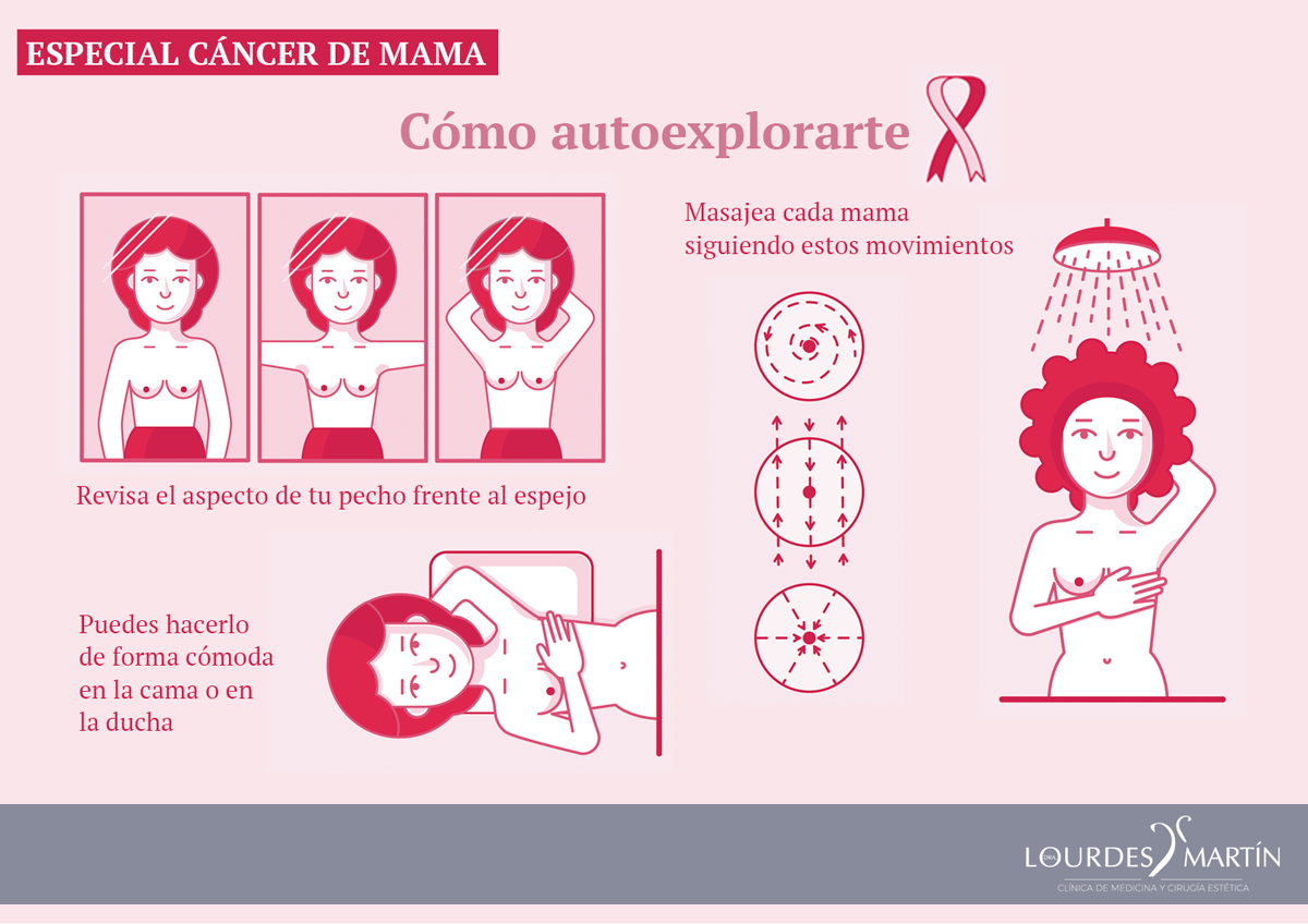 autoexploracion-cancer-mama-micropigmentacion-areola-sevilla